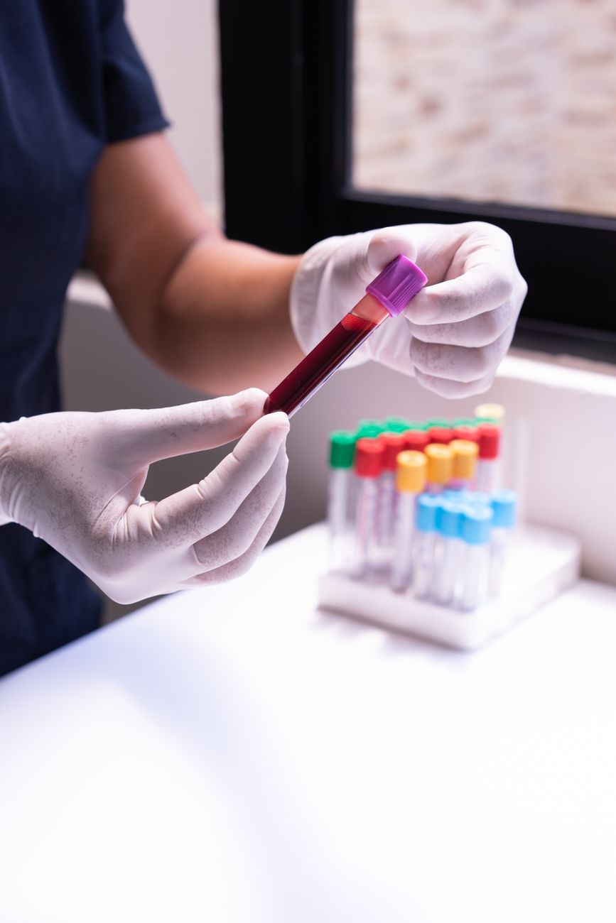 Badanie laboratoryjne i konsultacja medyczna